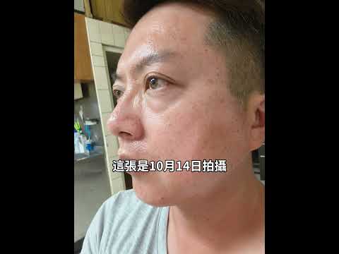 跟我一起不藥美 #宏寶家賀 #天麗生技 #高滲透微代謝#醫學美容保養品#馬來西亞#新加坡