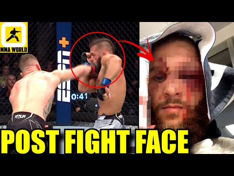 This is what 15 mins with Justin Gaethje inside the octagon did to Rafael Fiziev's face,UFC 286,MMA