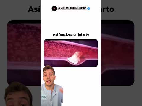 Infarto al corazón #consejossaludables #urgencia #primerosauxilios