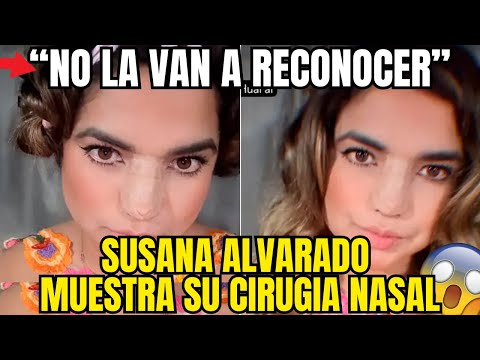SUSANA ALVARADO IMPACTA AL MOSTRAR SU NUEVA NARIZ Y NADIE LO PUEDE CREER