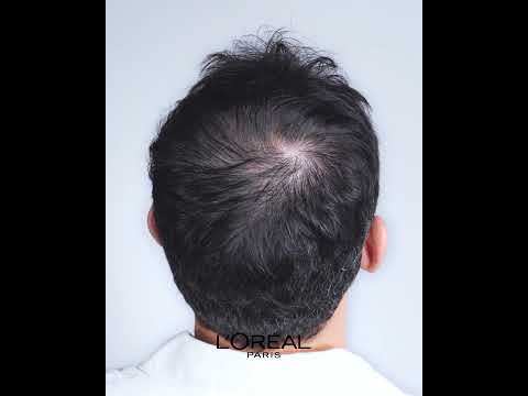 Density Booster Hereditary Testimonial by L'Oréal Paris