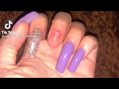 My girlfriend nail came off in her kitty kat (*Must See Her Hand*) 😂