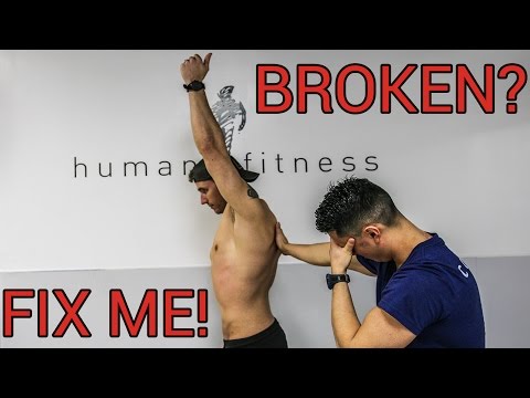 IM BROKEN! FIXING MY POSTURE AND MOBILITY - UCHZ8lkKBNf3lKxpSIVUcmsg