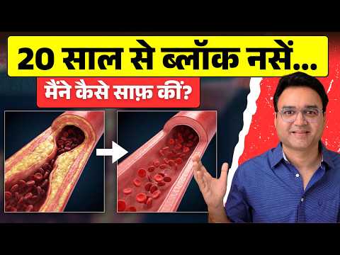 20 साल पुरानी Blockage मैंने कैसे Reverse की? 😱 | Clear Your Clogged Arteries 