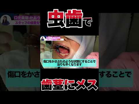 虫歯だけど歯茎にメスを入れます!