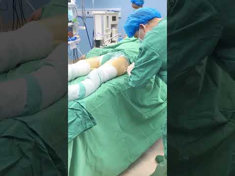 The doctor wrapped the patient's leg completely in bandages. Why did he do that? #doctor