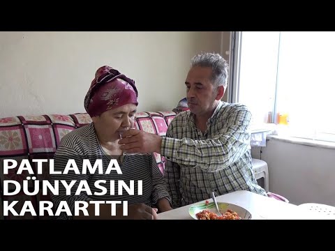İş Yerindeki Patlamada Görme Yetisini Yüzde 70 Kaybetti