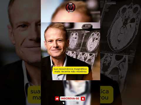 Ele venceu um dos cânceres mais letais do mundo #ciencia #cura #câncer #medicina #pesquisa