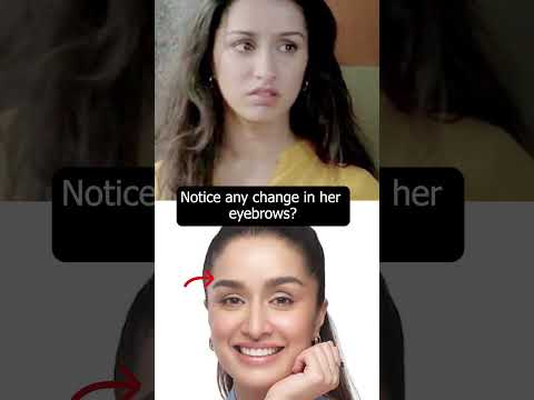 Which plastic surgeries Shraddha Kapoor has undergone?