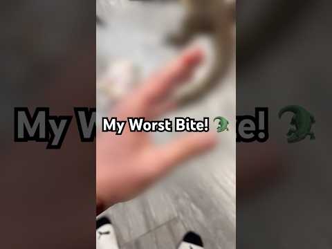 My worst reptile bites‼️ 