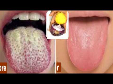 Remove smelling mouth properly cleanse your tongue, whiter teeth
