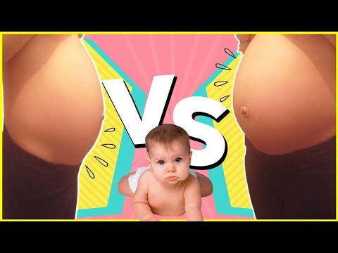 MIS EMBARAZOS 🥰 PREGUNTAS y RESPUESTAS con ZAIDA y ÁLEX 🧡 Como CUIDARSE en el EMBARAZO🤰STORY TIME
