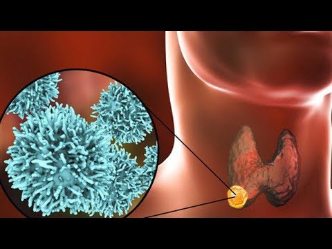 갑상선 건강에 좋은 루바브|[HealthTips]