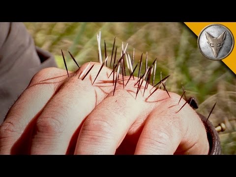 YIKES! Quilled by a Porcupine! - UC6E2mP01ZLH_kbAyeazCNdg