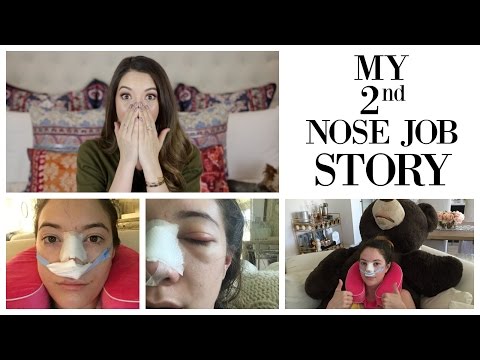 Why I Got Another Nose Job + My Revision Rhinoplasty Story | Blair Fowler - UC48DOiEvCDu3sThBijwkQ1A