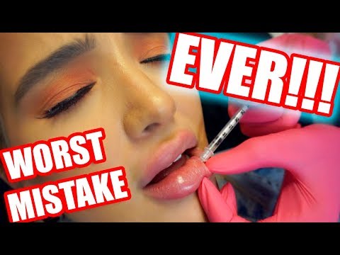 WHY I GOT MY LIP FILLER DISSOLVED - UCEZtkE45zjun9zROKtcqOcQ