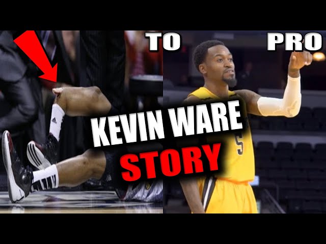 Kevin Ware’s Basketball Injury: What We Know