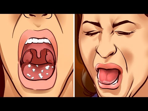 10 Ways to Stop Bad Breath and Get Rid of Mouth Bacteria - UC4rlAVgAK0SGk-yTfe48Qpw