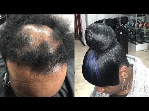 High Bun W/ Bang on Severe Alopecia Tutorial - UC5j1n97VJ1EPFPRPr0zY8vg