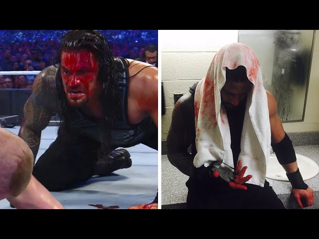 Is The Blood Real In WWE?