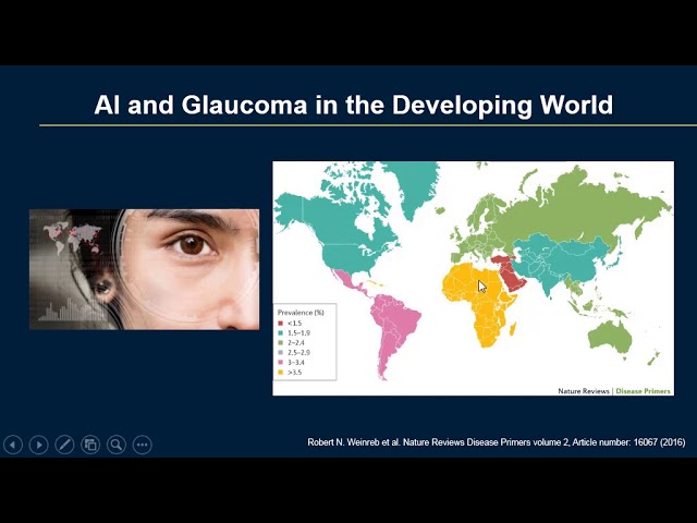 Deep Learning May Help Detect Glaucoma Sooner