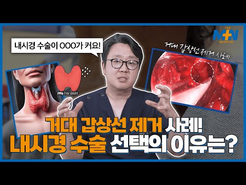 쉽지 않은 거대 갑상선 제거! 원장님이 내..