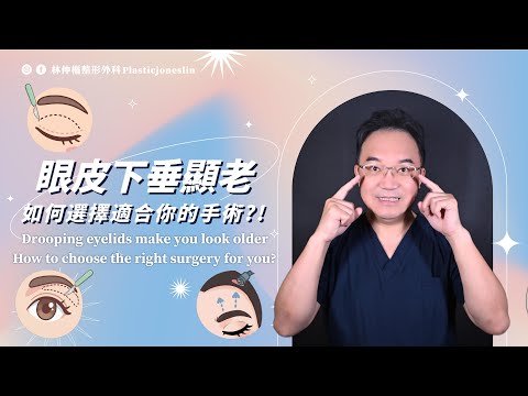 【美貌知尋識ep70-皮老化手術怎麼選？關鍵其實只有兩點】