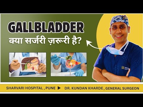 Gallbladder Stones (Gallstones): Causes, Symptoms & Treatment | Dr. Kundan Kharde #gallbladderstone