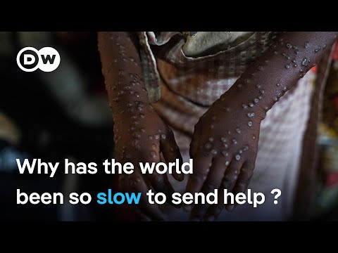 First doses of long-awaited mpox vaccines arrive in DR Congo | DW News