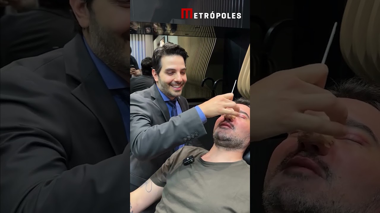Fernando Zor mostra resultado da rinoplastia conjunta com a namorada