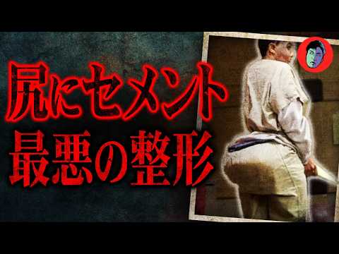 顔と尻にセメント注入…破格の整形で人生奪う毒医者