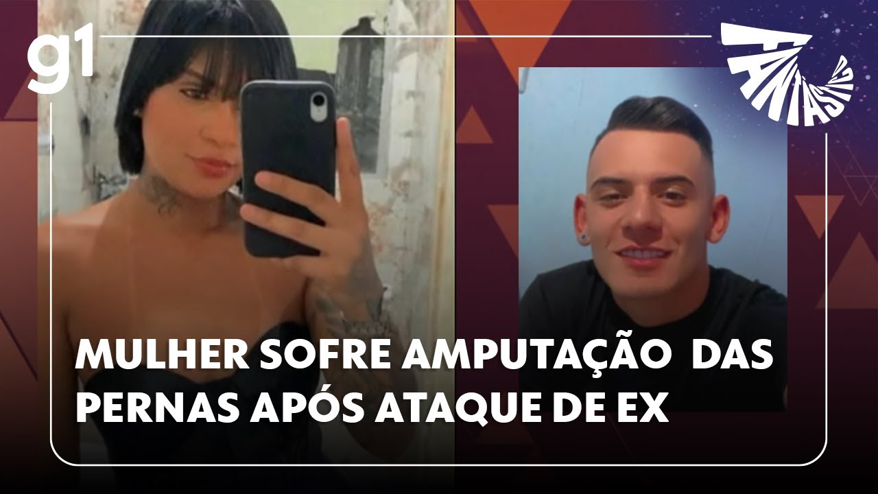 Mulher sofre amputação das pernas após ser atropelada e arrastada pelo ex em São Paulo