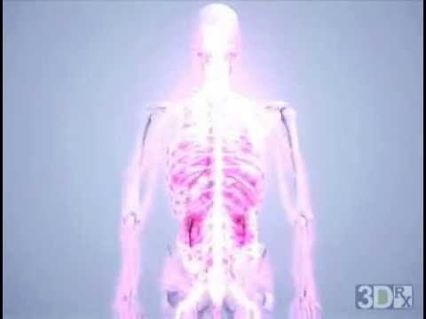 Cervical Subluxation - YouTube