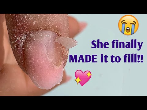 Anna Never Made it This FAR - 3 weeks, no broken nails! | Bitten Nails Fill