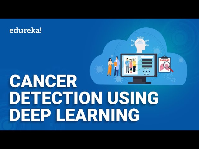 Breast Cancer Prediction Using Deep Learning