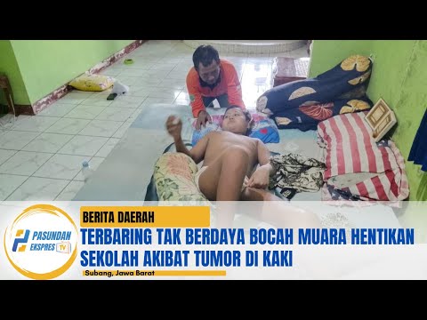 Terbaring Tak Berdaya Bocah Muara Hentikan Sekolah Akibat Tumor di Kaki