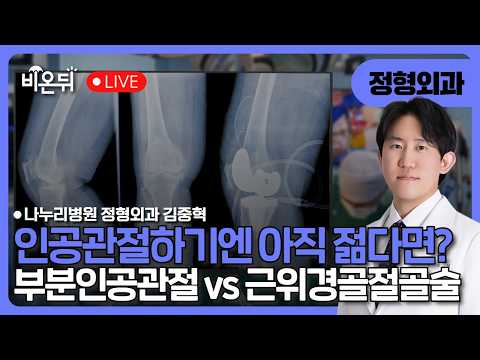 부분인공관절 vs 근위경골절골술/ 나누리병원 정형외과 <strong>김중혁</strong>