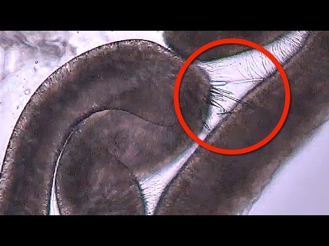 Jellyfish Stinging in MICROSCOPIC SLOW MOTION - Smarter Every Day 120 - UC6107grRI4m0o2-emgoDnAA