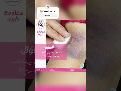 إعداد المخبري : حسن يسين  #Leukocyte#med_life