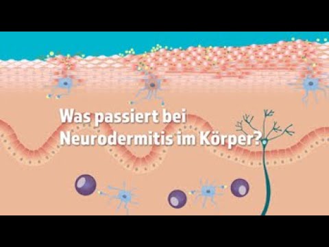 Was passiert bei Neurodermitis im Körper?