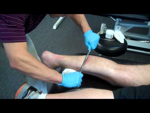 Graston Technique - Foot & Plantar Fasciitis - UC5vNXw3vTLGKKn_pxwN1xmQ