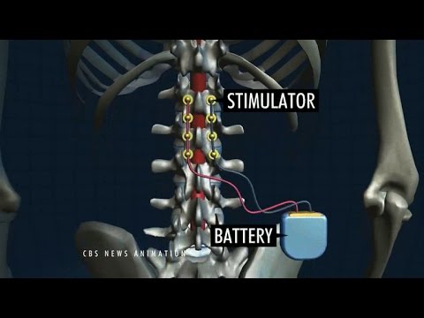 Next Big Thing - Wearables that are changing lives - UCOmcA3f_RrH6b9NmcNa4tdg