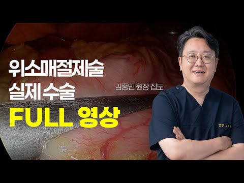 수술 진행 과정 모두 공개. 위소매절제술이..