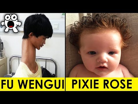 Top 10 Real Kids Born With Unbelievable Incredible Features - UCkQO3QsgTpNTsOw6ujimT5Q