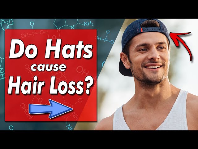 Does Wearing A Baseball Hat Cause Hair Loss?