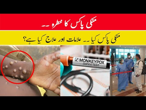 Monkeypox Cases in Pakistan