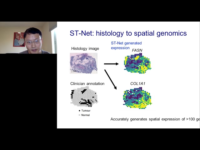 How Spatial Transcriptomics is Changing Deep Learning