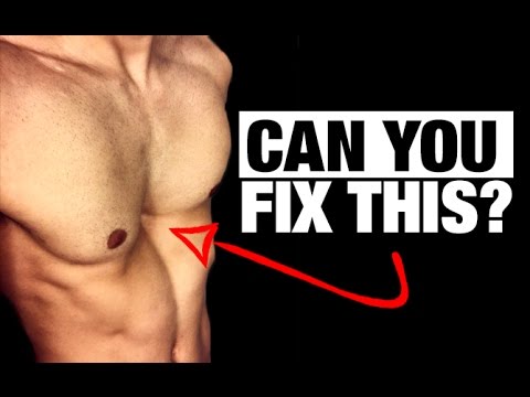 How to Fix a Sunken Chest! (PECTUS EXCAVATUM) - UCe0TLA0EsQbE-MjuHXevj2A