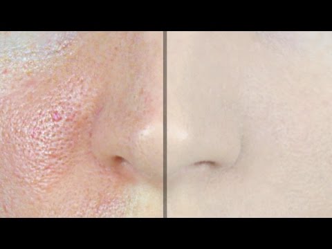 How to Make Pores Disappear! | STEPHANIE LANGE - UCZQ0XPE7wxMafUf8dIHOxgQ