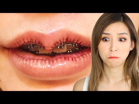 OMG Bizzare Lip Trend - UC0ng0jJflTuJBBH5DGvr1Pw